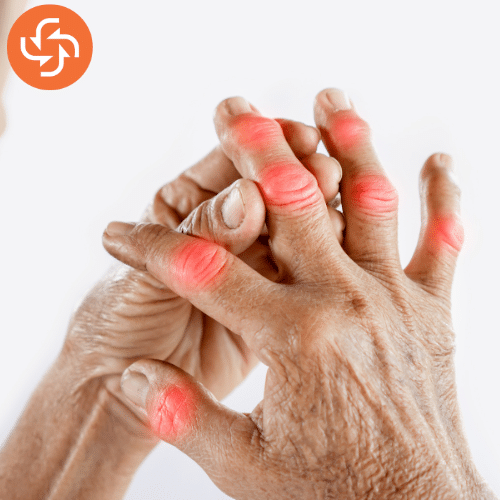 Close-up of aged hands with visible redness and swelling in finger joints, representing arthritis and chronic joint pain.