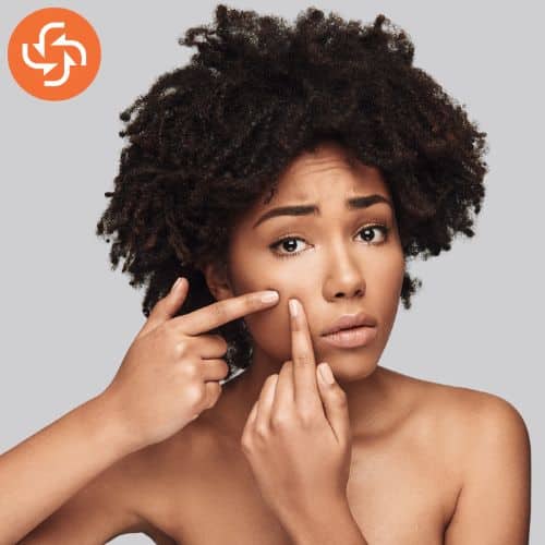 Young woman with curly hair squeezing a pimple on her cheek, showing concern about acne.