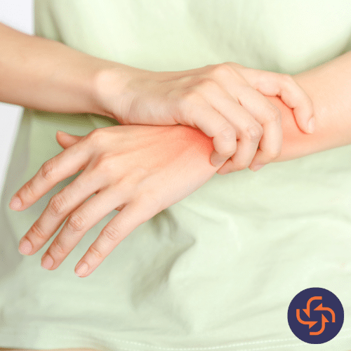 Person in a green shirt scratching a red, irritated patch on their wrist, representing skin allergy or eczema flare-up.
