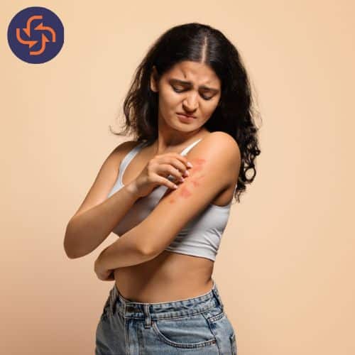 Woman scratching red, irritated rash on her arm, showing signs of skin allergy or eczema.