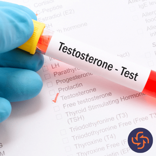 Gloved hand holding a blood sample tube labeled Testosterone Test over a medical lab report with hormone check options.