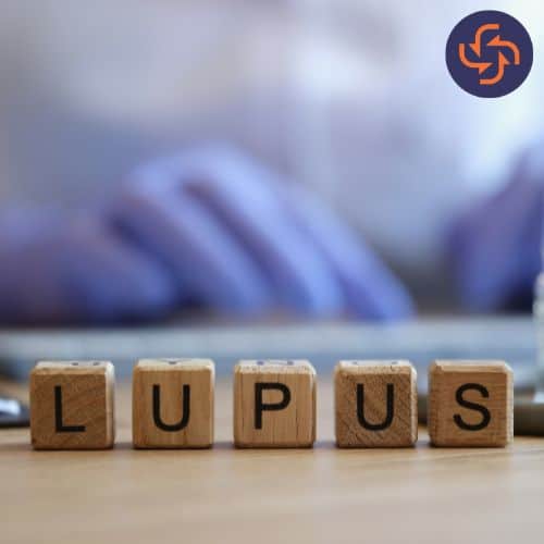 Wooden blocks spelling the word LUPUS with a blurred background of a person working on a laptop, symbolizing autoimmune disease awareness.